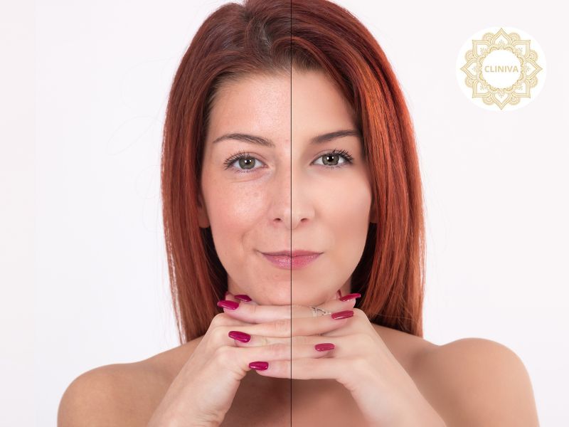 Inductores de Colágeno: Rejuvenece tu Piel de Forma Natural en Cliniva