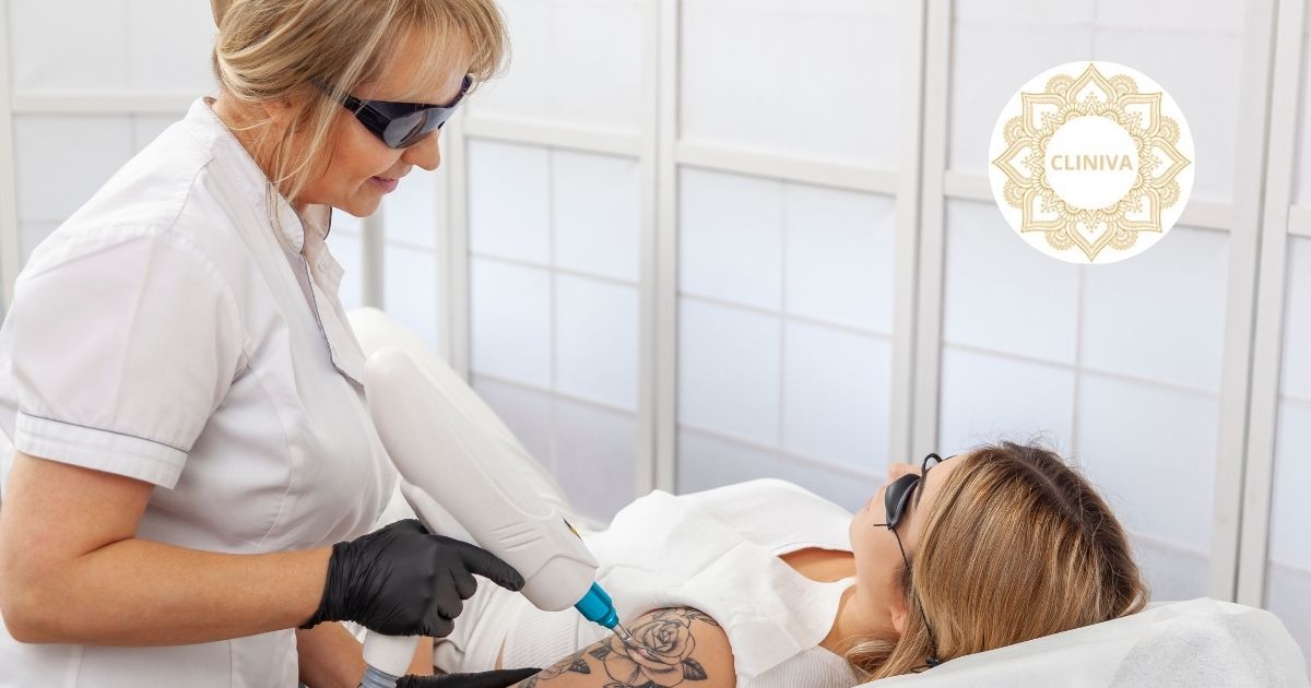 Eliminación de tatuajes con láser borrado eficaz y seguro en Fuengirola Eliminación de tatuajes con láser: borrado eficaz y seguro en Fuengirola